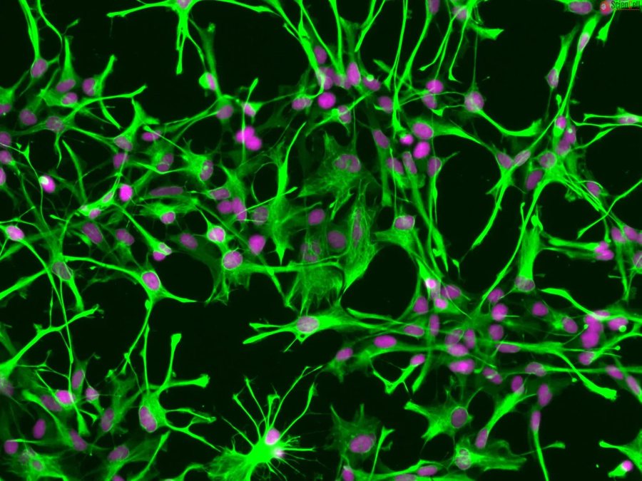 Human Astrocytes (HA)