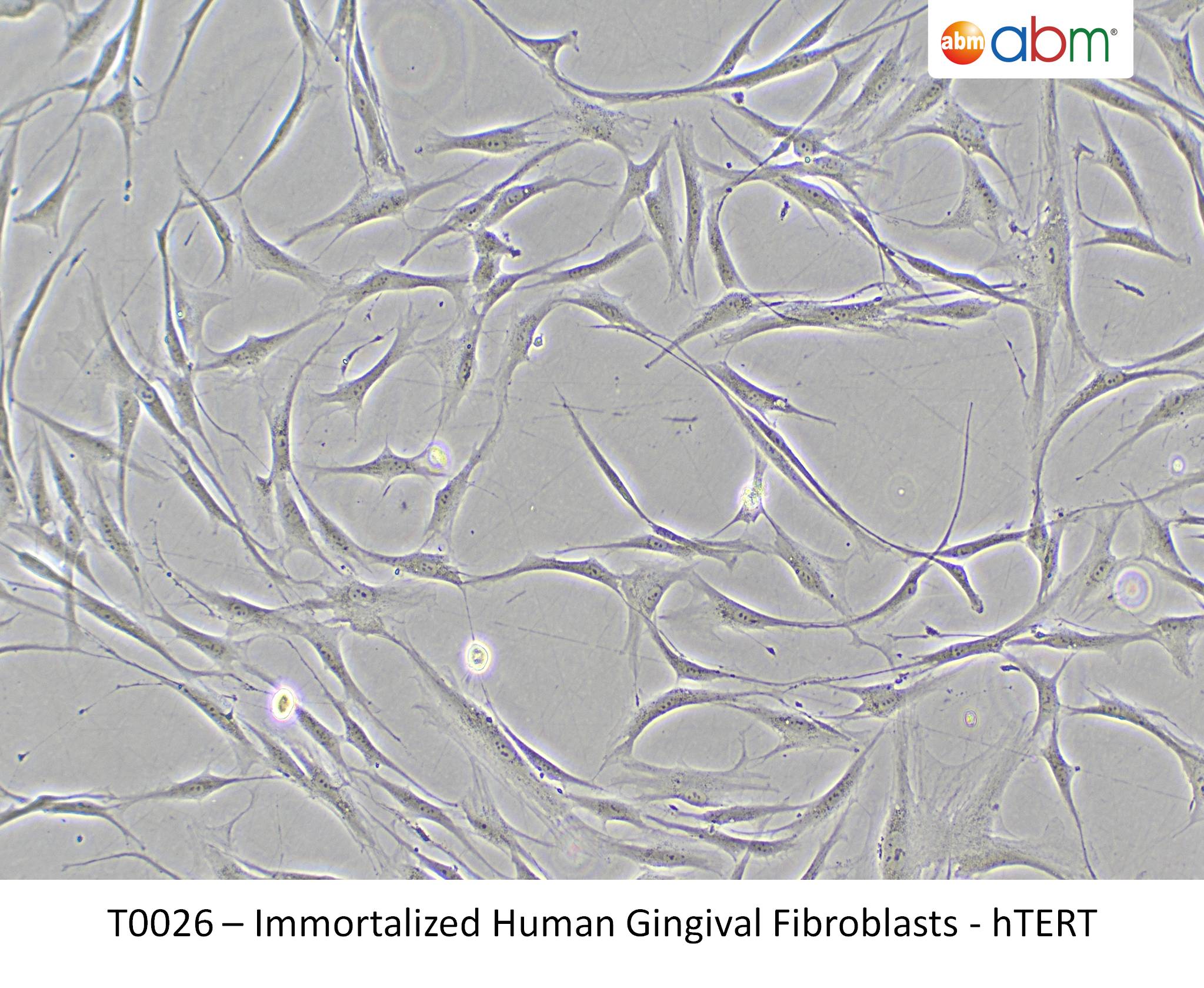 Immortalized Human Gingival Fibroblasts – hTERT